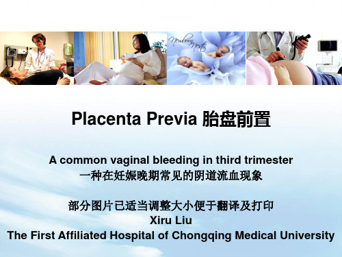 (妇产科学课件)8.3(参考翻译)Placenta Previa