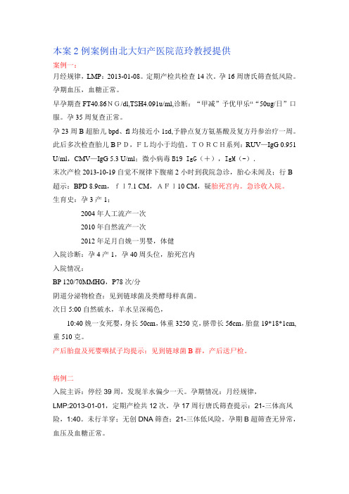 GBS案例