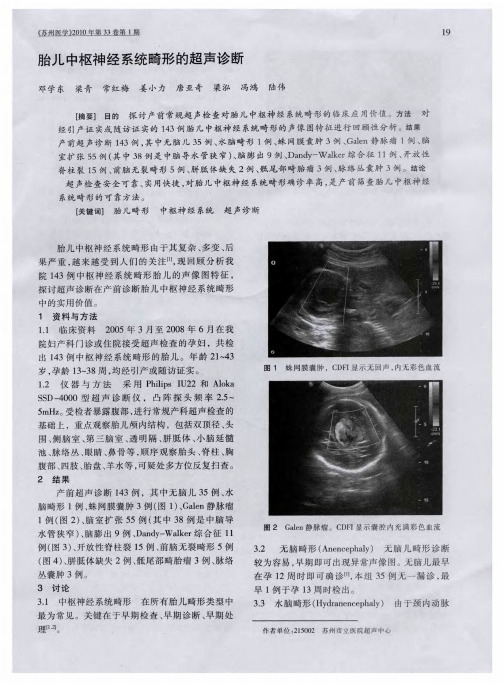 胎儿中枢神经系统畸形的超声诊断