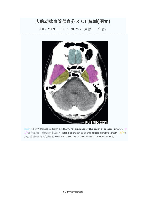 大脑动脉血管供血分区CT解剖