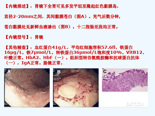 消化内镜图片