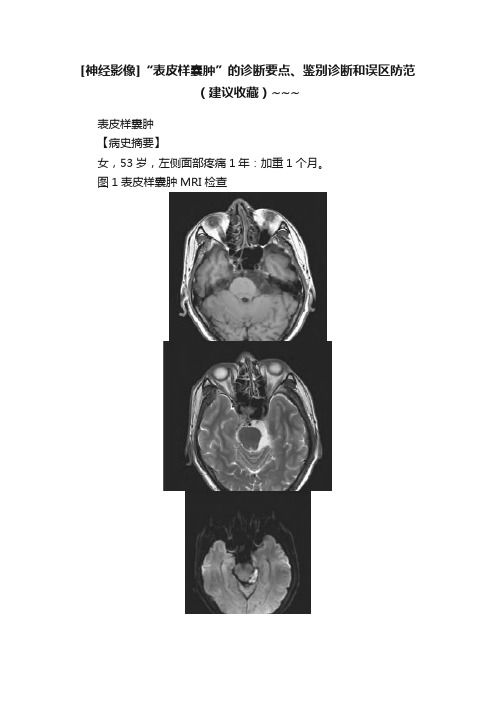 [神经影像]“表皮样囊肿”的诊断要点、鉴别诊断和误区防范（建议收藏）~~~