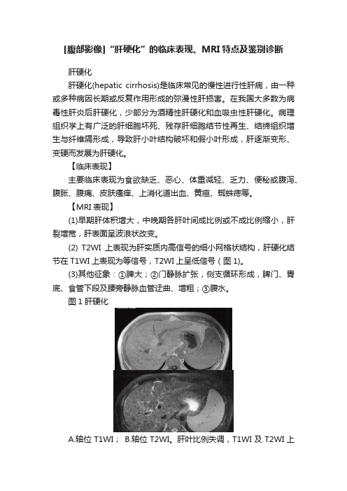 [腹部影像]“肝硬化”的临床表现、MRI特点及鉴别诊断