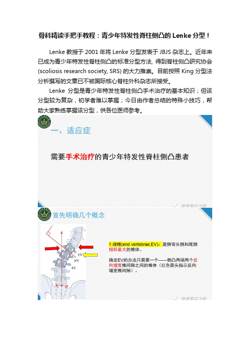 骨科精读手把手教程：青少年特发性脊柱侧凸的Lenke分型！