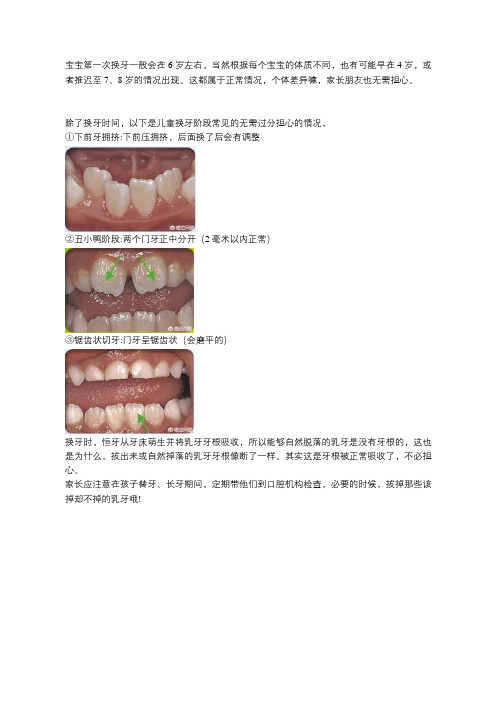 孩子换牙期需要注意些什么？