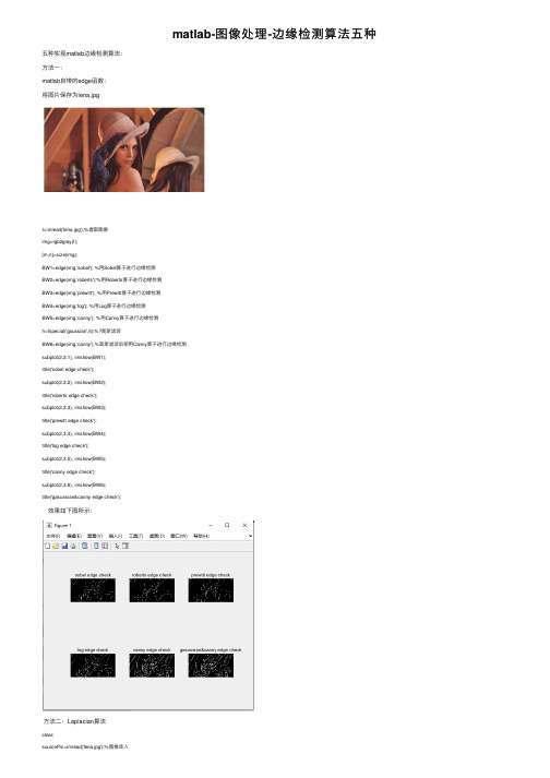 matlab-图像处理-边缘检测算法五种