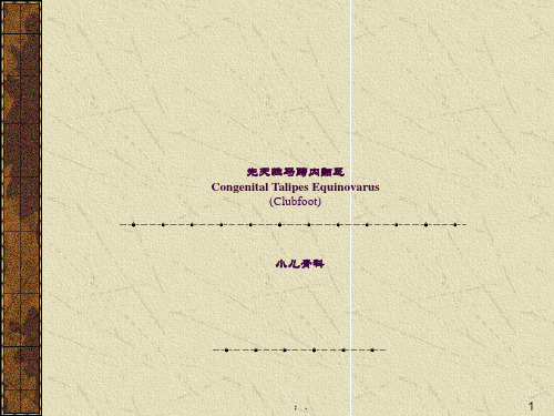 先天性马蹄内翻足讲课稿ppt课件