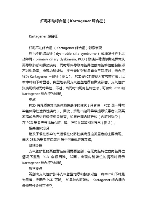 纤毛不动综合征（Kartagener综合征）