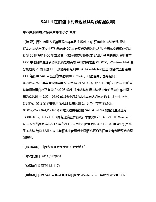 SALL4在肝癌中的表达及其对预后的影响