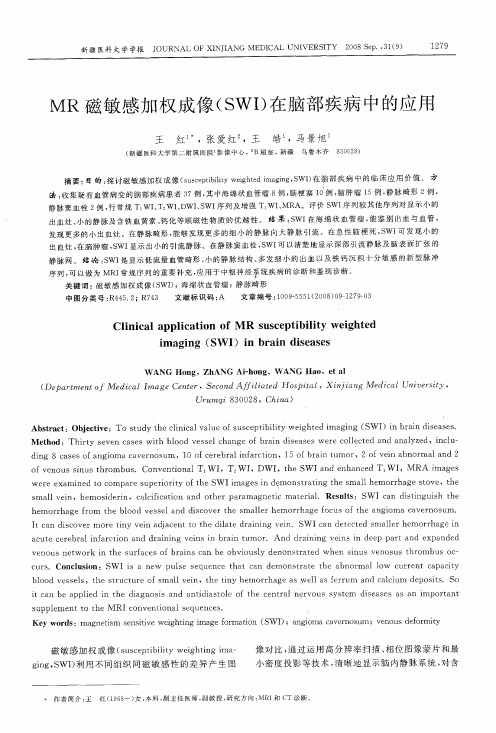 MR磁敏感加权成像(SWI)在脑部疾病中的应用