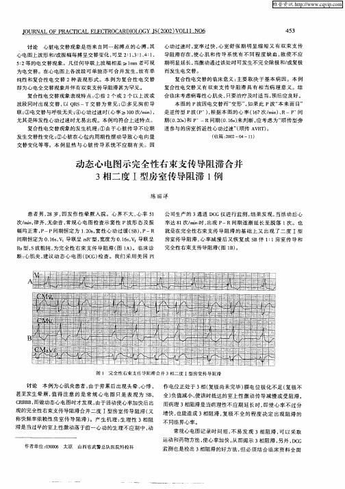 动态心电图示完全性右束支传导阻滞合并3相二度I型房室传导阻滞1例