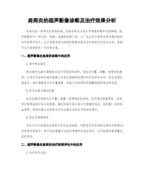 肩周炎的超声影像诊断及治疗效果分析