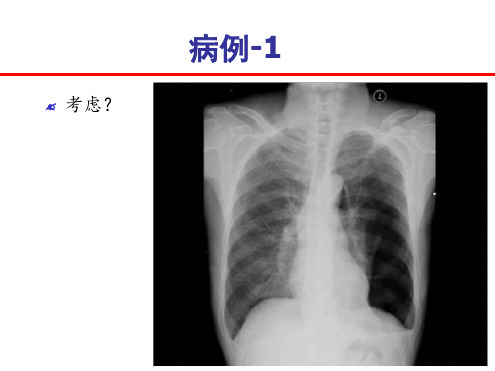 危重症患儿的早期识别课件