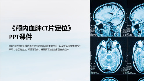 《颅内血肿CT片定位》课件