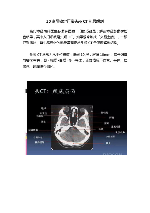 10张图搞定正常头颅CT断层解剖