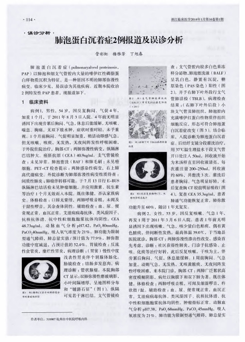 肺泡蛋白沉着症2例报道及误诊分析