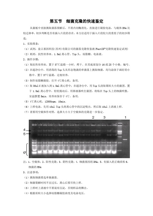 第五节  细菌克隆的快速鉴定