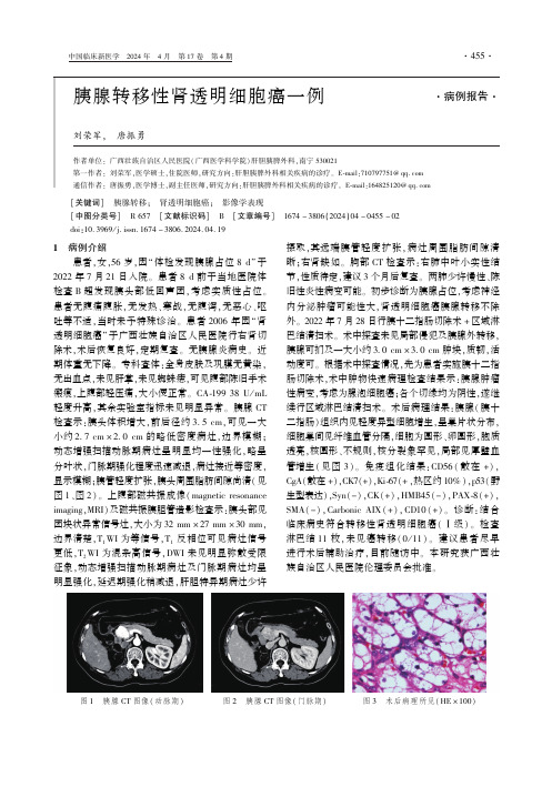 胰腺转移性肾透明细胞癌一例