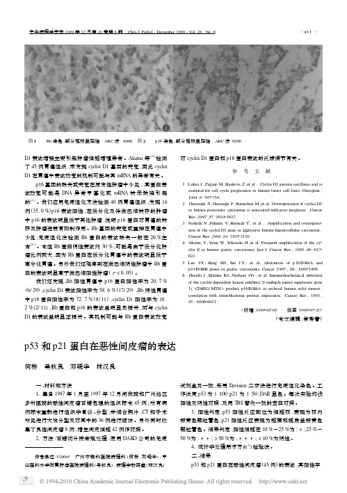 p53和p21蛋白在恶性间皮瘤的表达