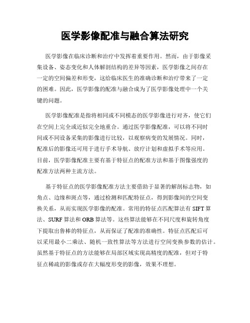 医学影像配准与融合算法研究