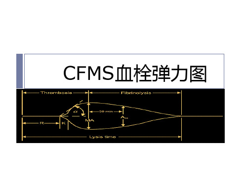 教你如何看血栓弹力图