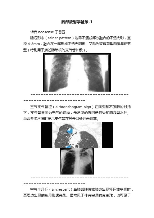 胸部放射学征象-1