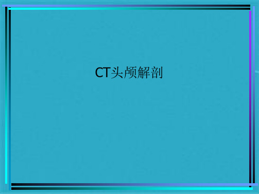 CT头颅解剖(共15张PPT)