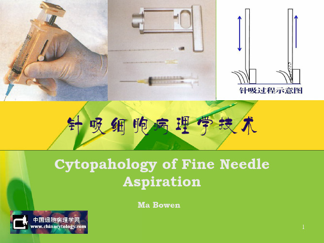 针吸细胞病理学技术