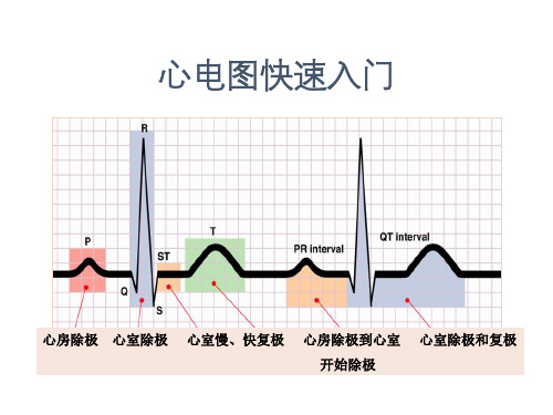 心电图快速入门