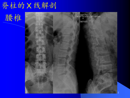 腰椎影像解剖学ppt课件