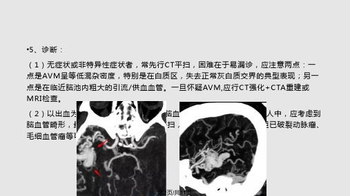 常见脑血管畸形的影像学表现