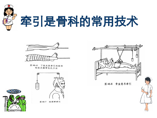 骨科常见牵引的种类及方法