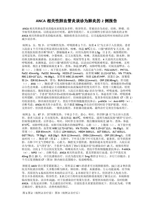 ANCA相关性肺血管炎误诊为肺炎的2例报告