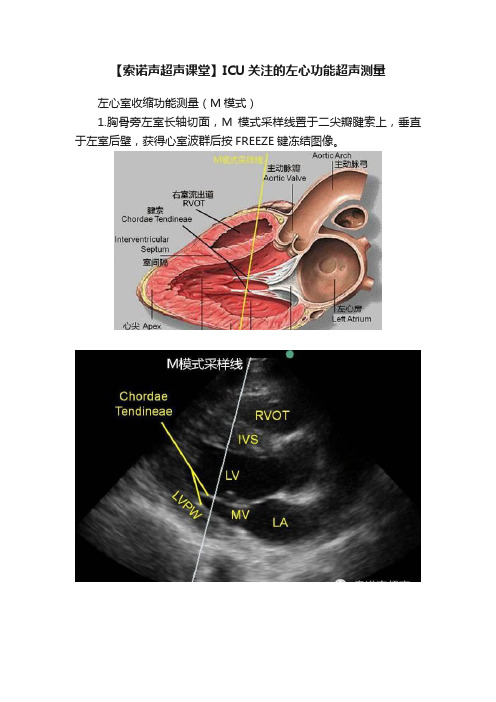 【索诺声超声课堂】ICU关注的左心功能超声测量