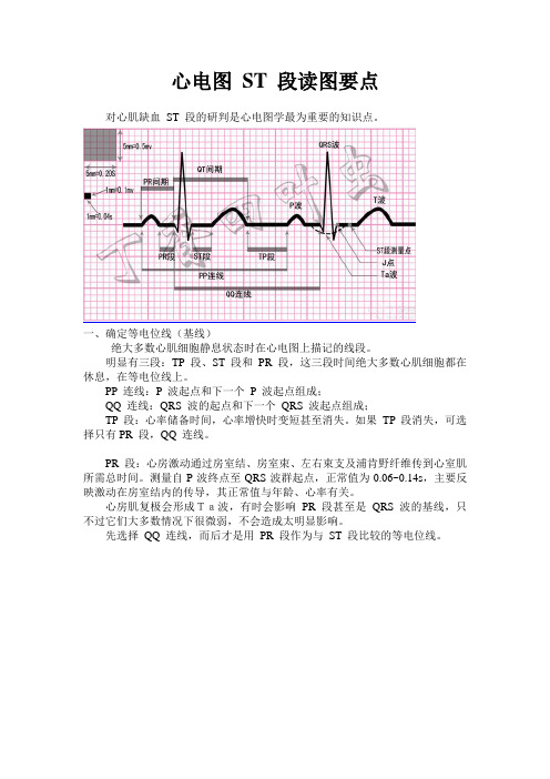 心电图ST段要点