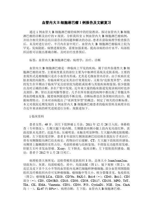 血管内大B细胞淋巴瘤1例报告及文献复习