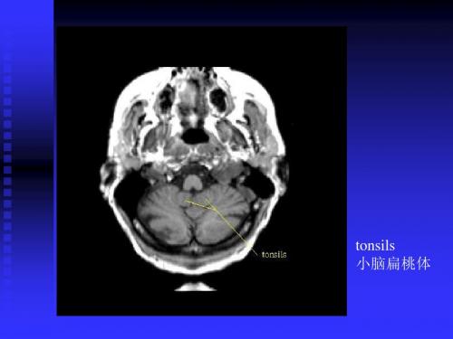 2018年神经影像学培训教材-精选资料