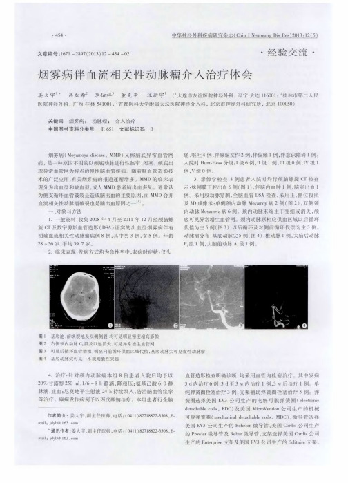 烟雾病伴血流相关性动脉瘤介入治疗体会