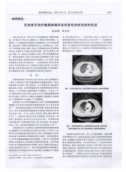 厄洛替尼治疗晚期肺癌并发间质性肺疾病病例报道