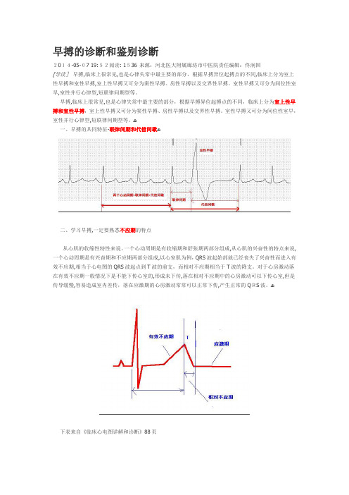 早搏的诊断和鉴别诊断