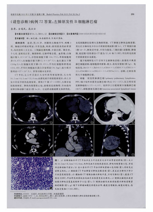 《请您诊断》病例72答案：左肺原发性B细胞淋巴瘤