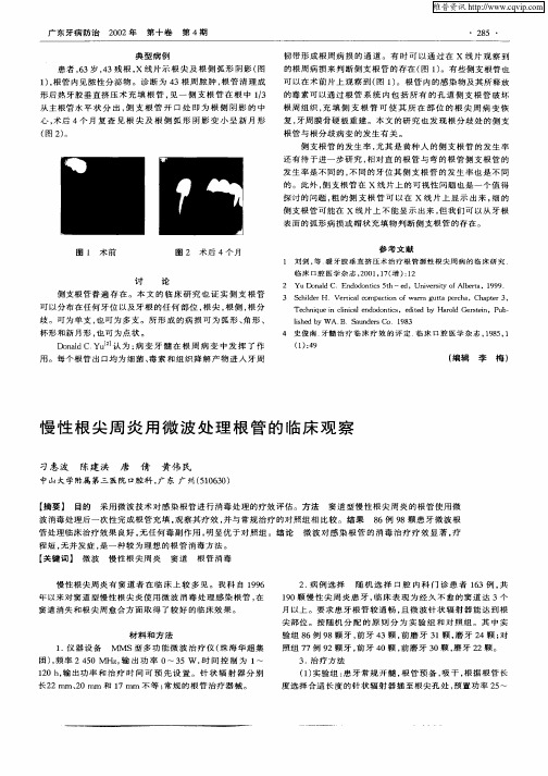 慢性根尖周炎用微波处理根管的临床观察