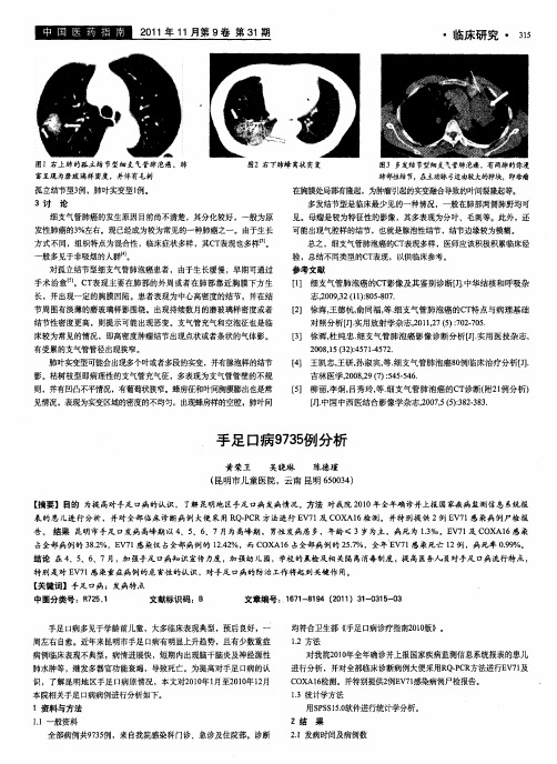 手足口病9735例分析