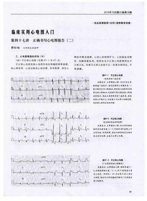 临床实用心电图入门 第四十七讲 正确书写心电图报告(二)