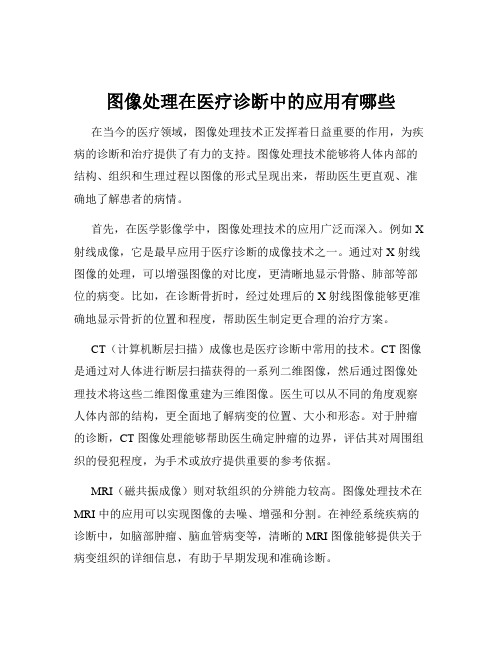 图像处理在医疗诊断中的应用有哪些