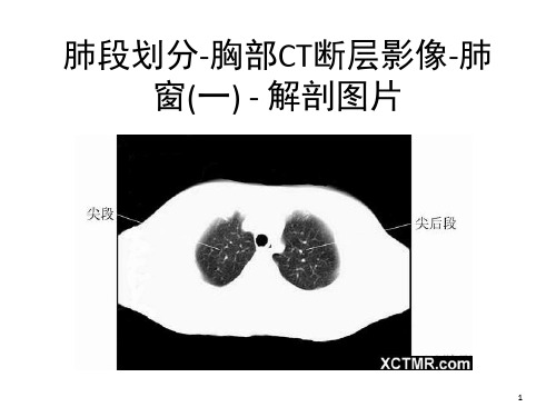 胸部CT肺段划分(课堂PPT)