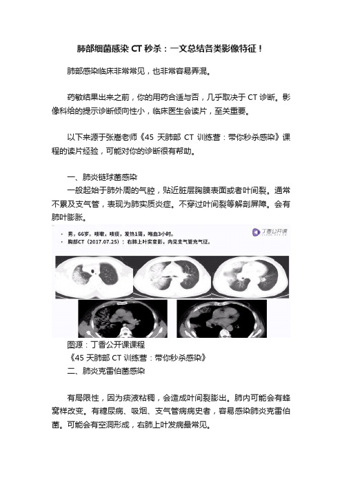 肺部细菌感染CT秒杀：一文总结各类影像特征！