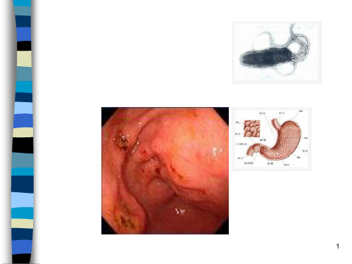 慢性胃炎PPT课件