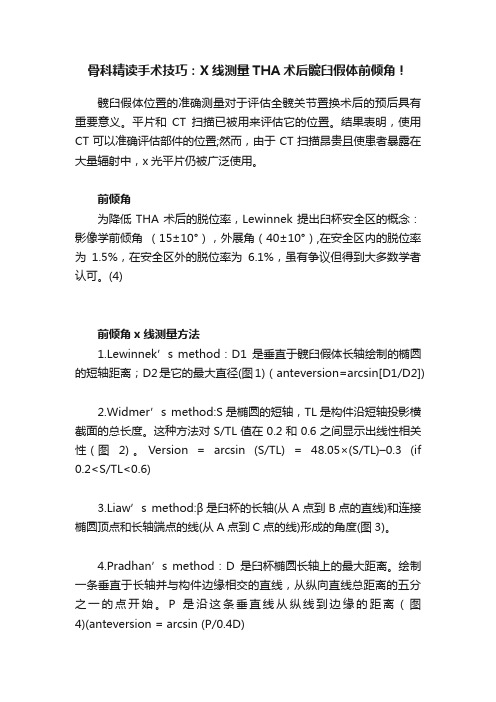 骨科精读手术技巧：X线测量THA术后髋臼假体前倾角！