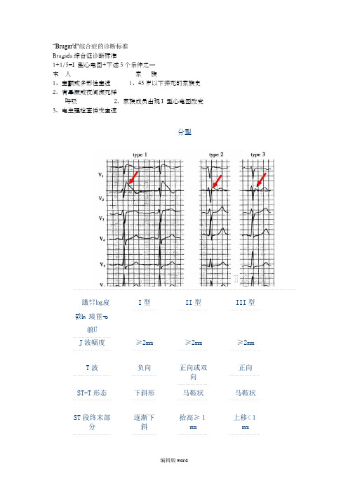 Brugada综合征诊断标准